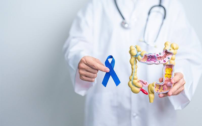 Doctor holding a colon model to explain cancer symptoms.